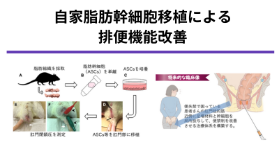 直腸癌術後排便機能障害に対する脂肪組織由来幹細胞および脂肪組織を用いた新規再生治療法の開発