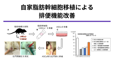 直腸癌術後排便機能障害に対する脂肪組織由来幹細胞および脂肪組織を用いた新規再生治療法の開発