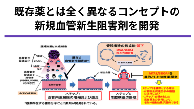 血管内皮細胞の管腔形成阻害を標的とした新規血管新生阻害剤の開発