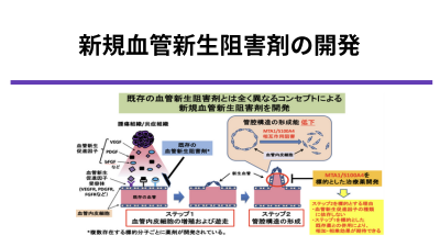 血管内皮細胞の管腔形成阻害を標的とした新規血管新生阻害剤の開発