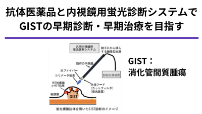 消化管間質腫瘍(GIST)に対する蛍光診断法の開発